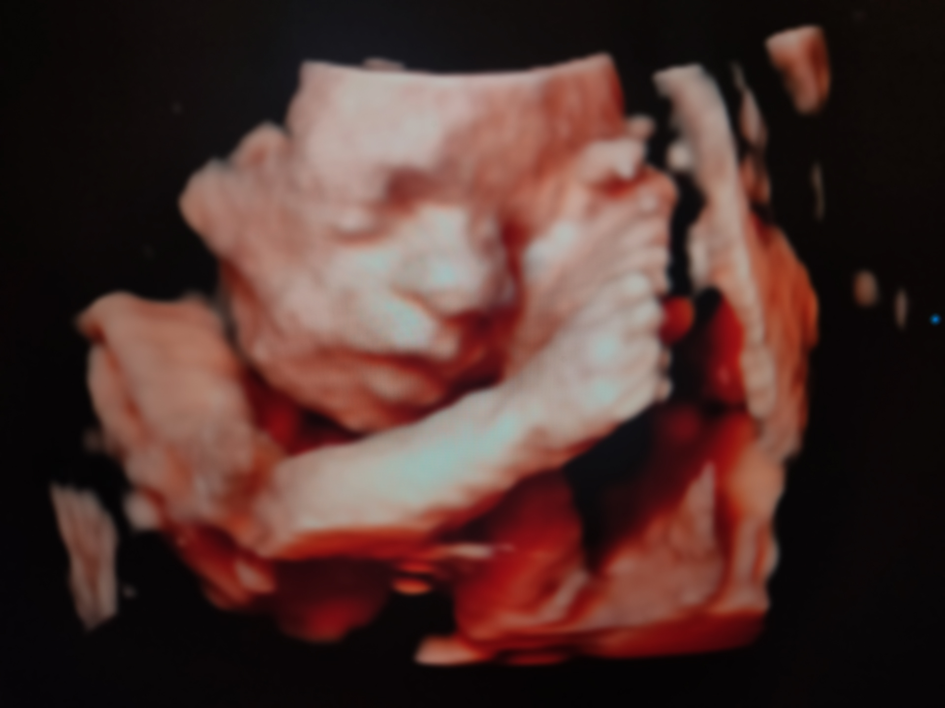 Featured image of post La 2eme grossesse de Manon